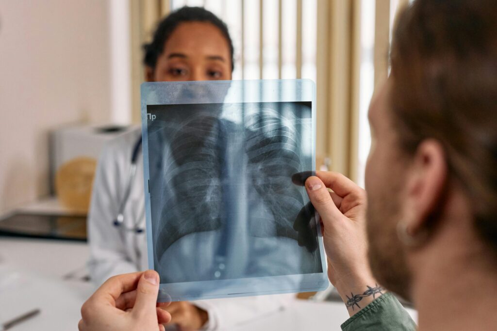 Cancer du poumon : à Nice, un dépistage gratuit pour les fumeurs et ex-fumeurs